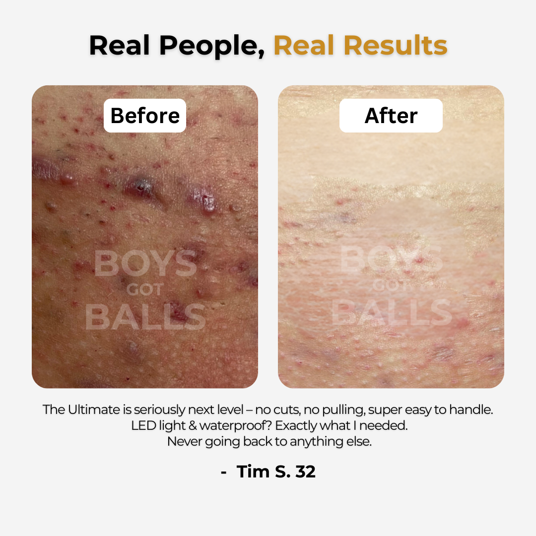 TheUltimate - For intimate and body care