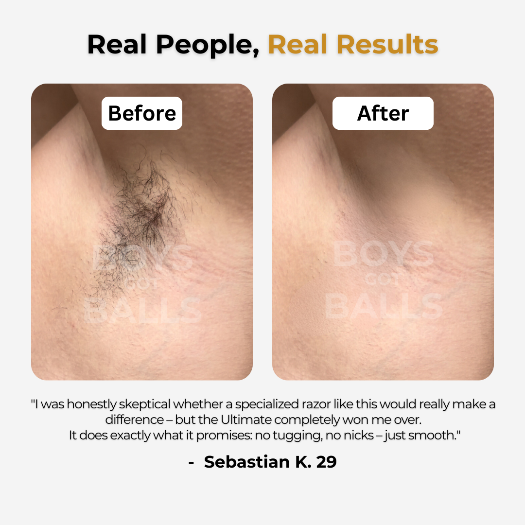 Shave Pro™ The razor for intimate and body care 