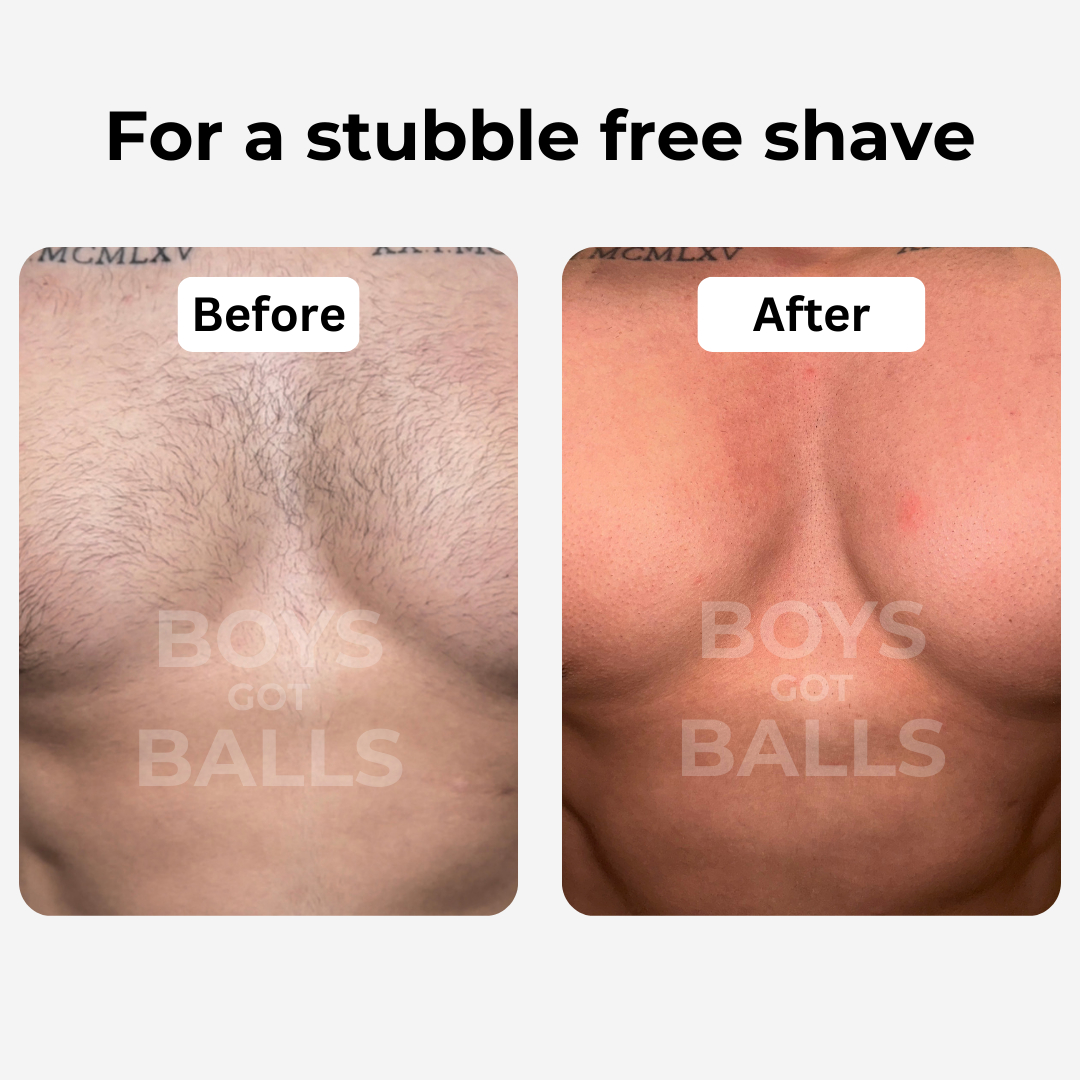 Shave Pro™ The razor for intimate and body care 